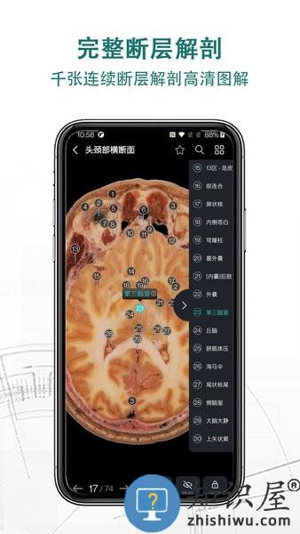 掌上3D解剖手机版 v2.6.3 安卓版