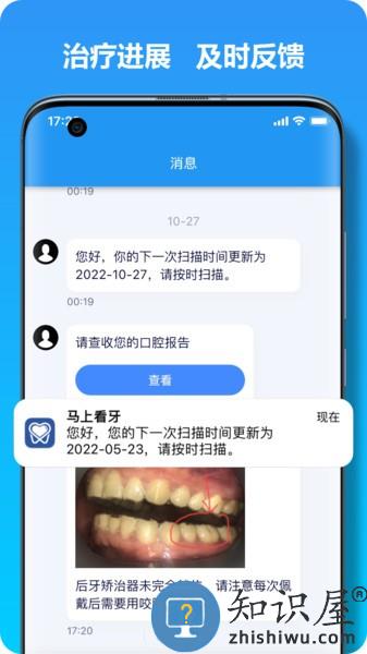 马上看牙软件 v2.3.6 安卓版