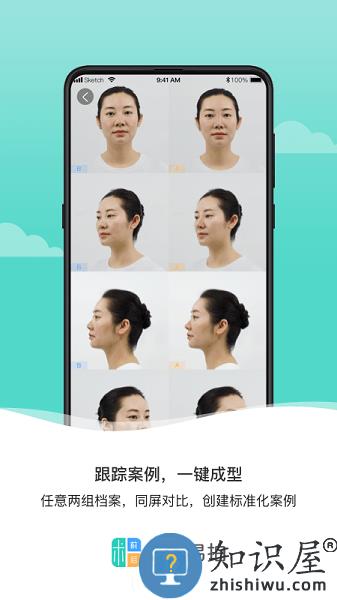 医美易拍软件 v2.0.2 安卓版