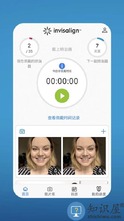 my invisalign 最新版本下载v5.4 安卓版