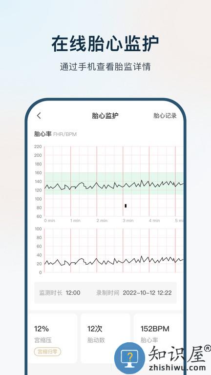 孕维软件